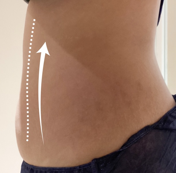 After Lost 5kg in 2 months treatment